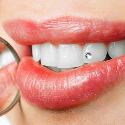 Tanddiamantjes Mondhygiëne Tiel